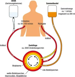 Ablauf der Spende